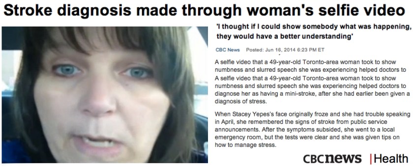 Stroke diagnosis made through womans selfie video